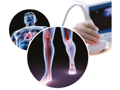 ecocolor-doppler-filograna ecocolor-doppler-filograna