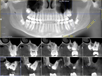 radiologia-dentale-filograna radiologia-dentale-filograna