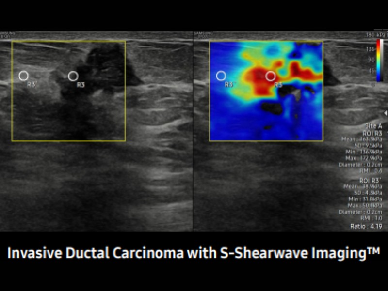 Esame carcinoma con shearware