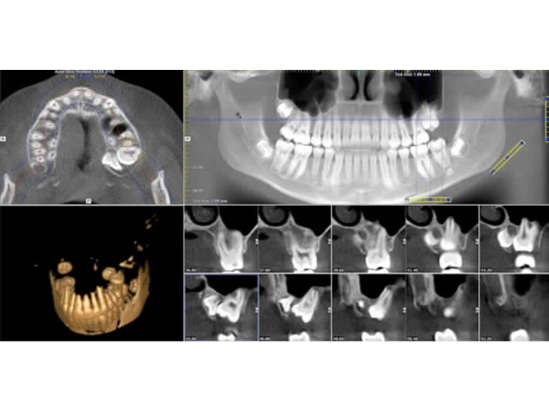 studio-filograna-radiologia-dentale-