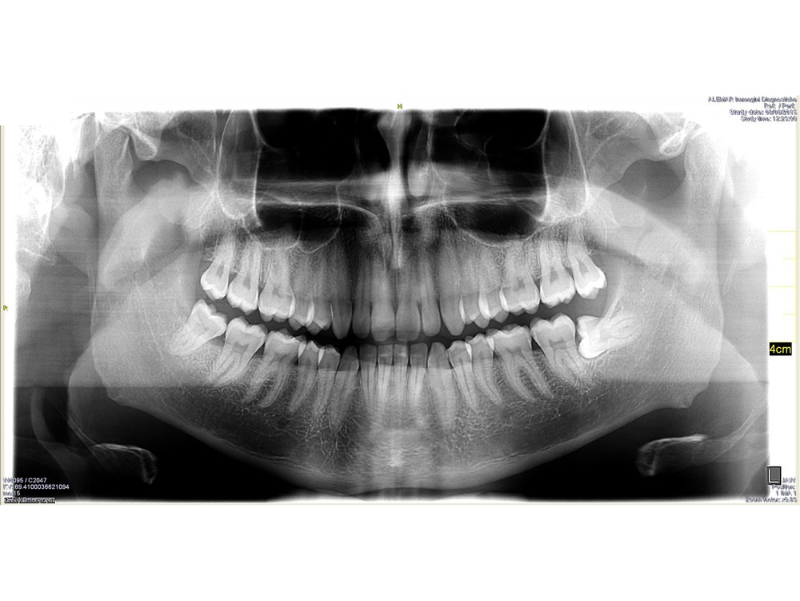 studio-filograna-radiologia-dentale